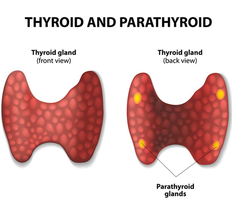 Hyperparathyroidism-UCI-Head-&-Neck Hyperparathyroidism-UCI-Head-&-Neck