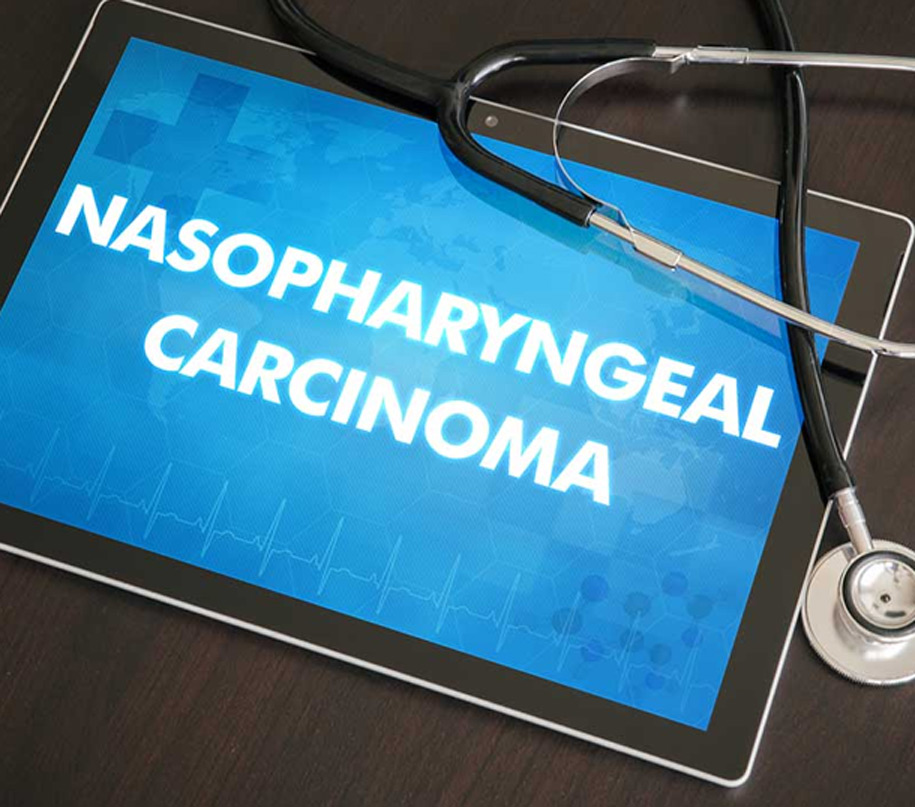 Nasopharyngeal-Cancer-UCI-Head-&-Neck