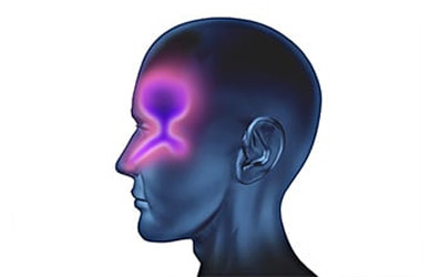 Sinus-Headaches